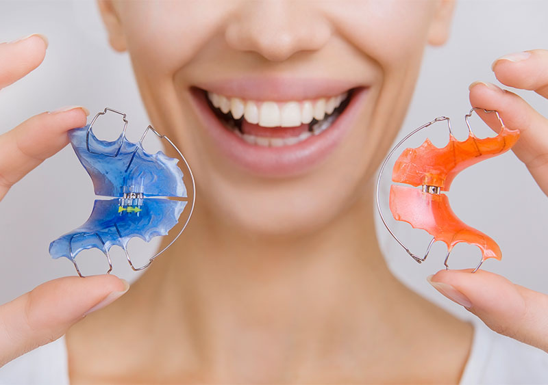 Benefits of Using a Removable Retainer