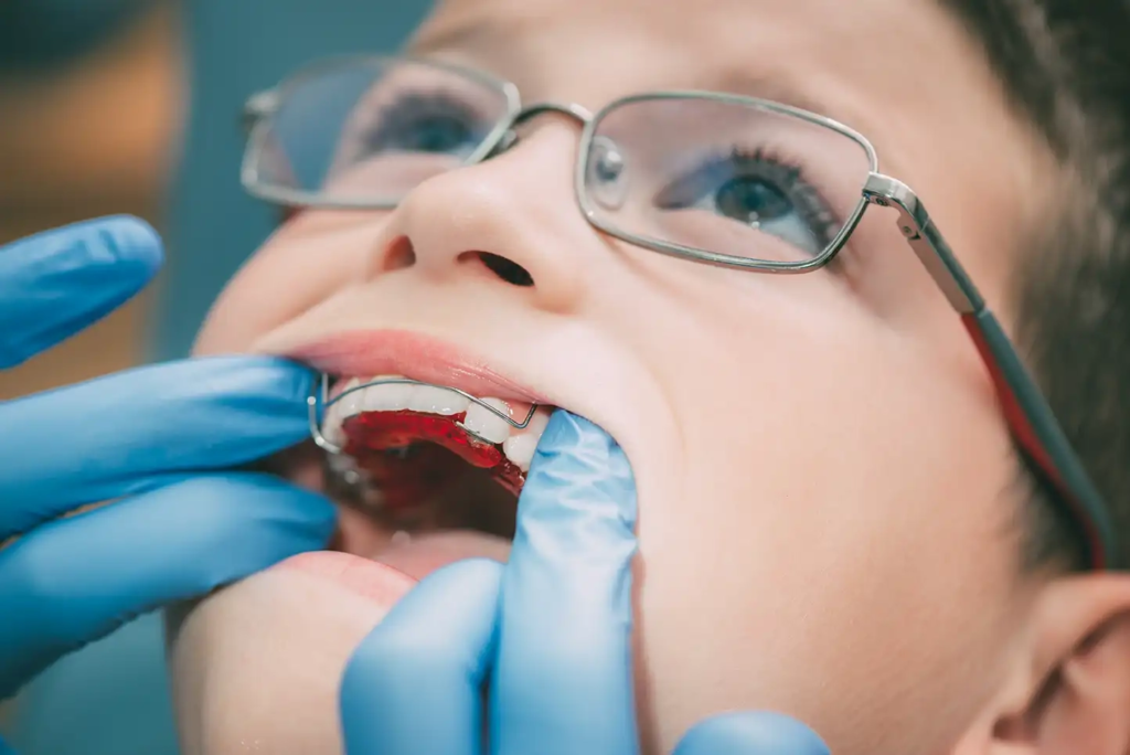 Child getting removable retainer fitted
