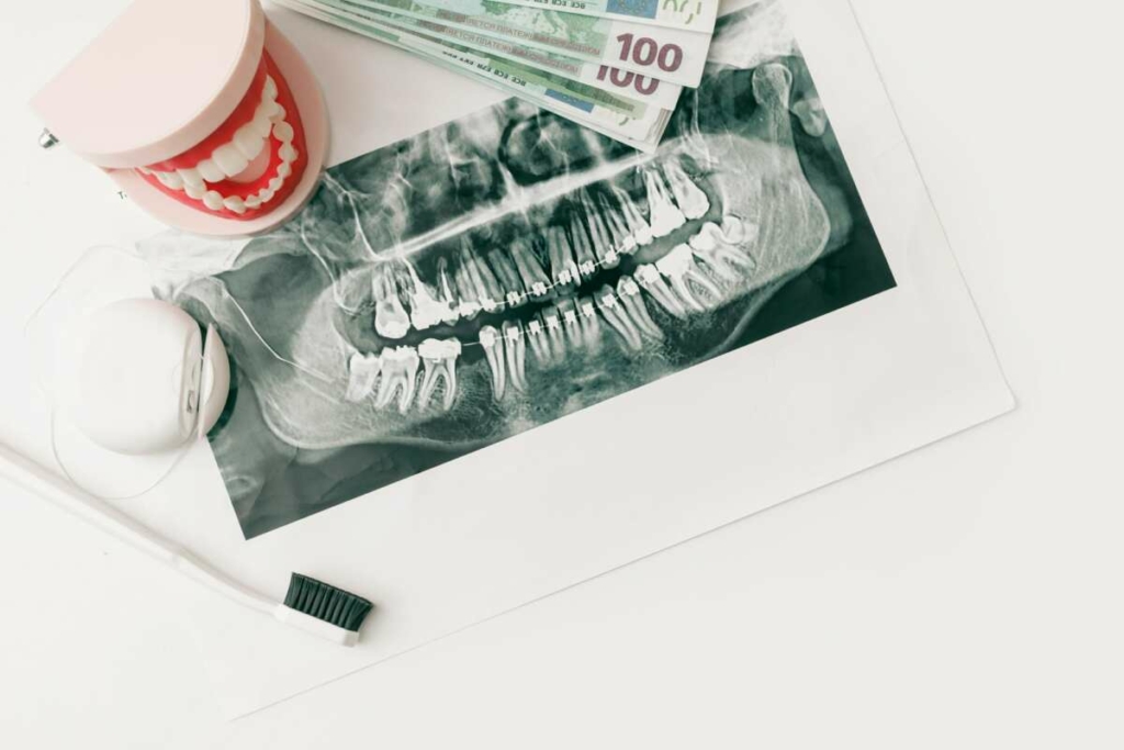 Jaw Model with Dental Panoramic X-ray and Money on White Background, Flat Lay. Affordable Orthodontic treatment